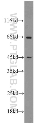 NF45 Antibody in Western Blot (WB)
