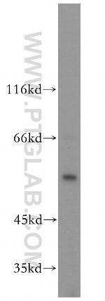 MPP1 Antibody in Western Blot (WB)