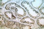 KLF6 Antibody in Immunohistochemistry (Paraffin) (IHC (P))