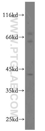 KLF6 Antibody in Western Blot (WB)