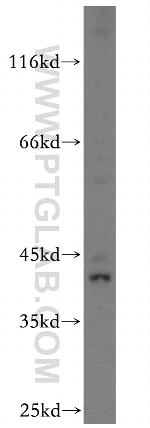 KLF6 Antibody in Western Blot (WB)