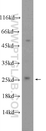 CNBP Antibody in Western Blot (WB)