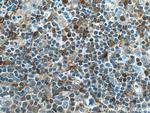 PHGDH Antibody in Immunohistochemistry (Paraffin) (IHC (P))