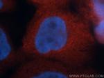 AHSA1 Antibody in Immunocytochemistry (ICC/IF)