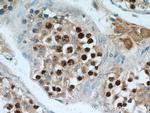 SPAG5 Antibody in Immunohistochemistry (Paraffin) (IHC (P))