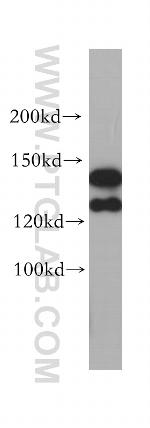SPAG5 Antibody in Western Blot (WB)
