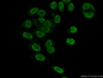 GPKOW Antibody in Immunocytochemistry (ICC/IF)