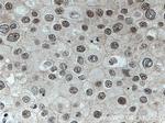 GPKOW Antibody in Immunohistochemistry (Paraffin) (IHC (P))