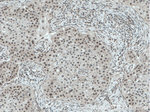 GPKOW Antibody in Immunohistochemistry (Paraffin) (IHC (P))