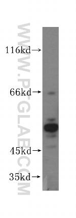 GPKOW Antibody in Western Blot (WB)