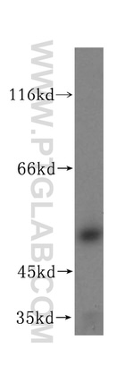 GPKOW Antibody in Western Blot (WB)