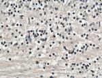 TMEM98 Antibody in Immunohistochemistry (Paraffin) (IHC (P))