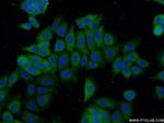 hD53/TPD52L1 Antibody in Immunocytochemistry (ICC/IF)