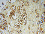 hD53/TPD52L1 Antibody in Immunohistochemistry (Paraffin) (IHC (P))