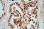 hD53/TPD52L1 Antibody in Immunohistochemistry (Paraffin) (IHC (P))