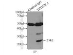 hD53/TPD52L1 Antibody in Immunoprecipitation (IP)