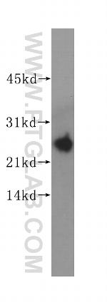 hD53/TPD52L1 Antibody in Western Blot (WB)