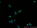 COPB2 Antibody in Immunocytochemistry (ICC/IF)