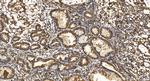 COPB2 Antibody in Immunohistochemistry (Paraffin) (IHC (P))