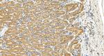 COPB2 Antibody in Immunohistochemistry (Paraffin) (IHC (P))