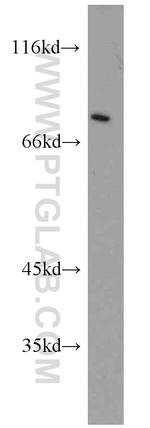 Muskelin Antibody in Western Blot (WB)
