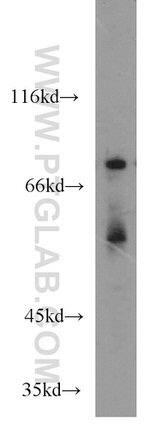 Muskelin Antibody in Western Blot (WB)