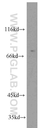 Muskelin Antibody in Western Blot (WB)