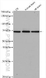 CDK5RAP1 Antibody in Western Blot (WB)