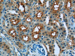 IVNS1ABP Antibody in Immunohistochemistry (Paraffin) (IHC (P))