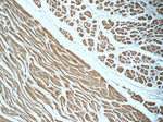 IVNS1ABP Antibody in Immunohistochemistry (Paraffin) (IHC (P))