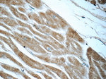 IVNS1ABP Antibody in Immunohistochemistry (Paraffin) (IHC (P))
