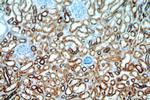 IVNS1ABP Antibody in Immunohistochemistry (Paraffin) (IHC (P))