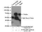 IVNS1ABP Antibody in Immunoprecipitation (IP)