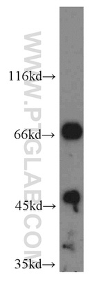 IVNS1ABP Antibody in Western Blot (WB)