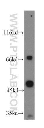 IVNS1ABP Antibody in Western Blot (WB)