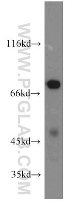 IVNS1ABP Antibody in Western Blot (WB)