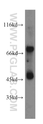 IVNS1ABP Antibody in Western Blot (WB)