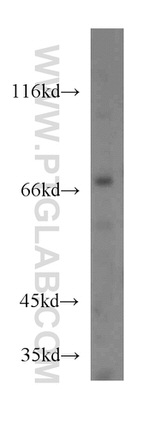 IVNS1ABP Antibody in Western Blot (WB)