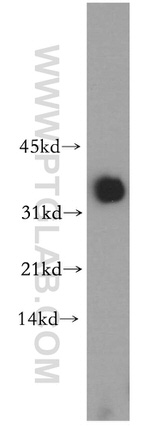 PDHB Antibody in Western Blot (WB)