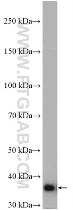 PDHB Antibody in Western Blot (WB)