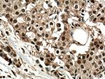 PSMD2 Antibody in Immunohistochemistry (Paraffin) (IHC (P))