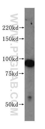 PSMD2 Antibody in Western Blot (WB)
