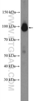 PSMD2 Antibody in Western Blot (WB)