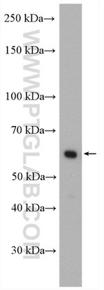 CORO1C Antibody in Western Blot (WB)