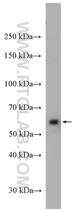 CORO1C Antibody in Western Blot (WB)