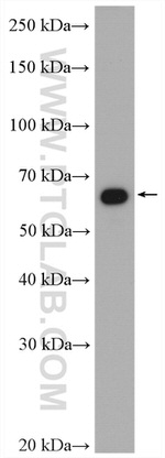 CORO1C Antibody in Western Blot (WB)