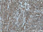 CORO1C Antibody in Immunohistochemistry (Paraffin) (IHC (P))