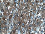 CORO1C Antibody in Immunohistochemistry (Paraffin) (IHC (P))