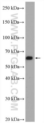CORO1C Antibody in Western Blot (WB)