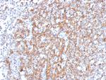 Cystatin A Monoclonal Antibody (CSTA, 3553)